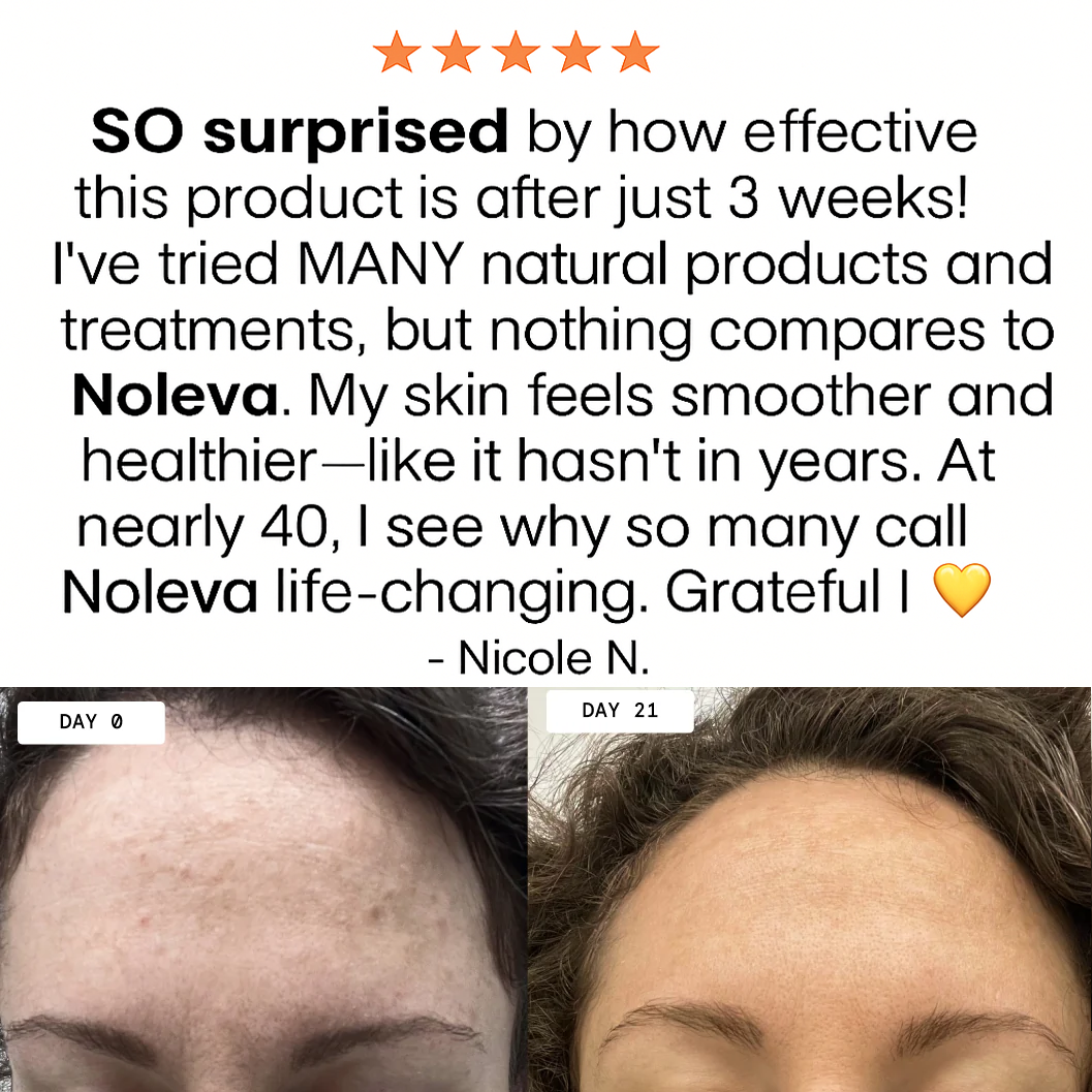 Retinol Boosting Shot Ampoule Nolevea™